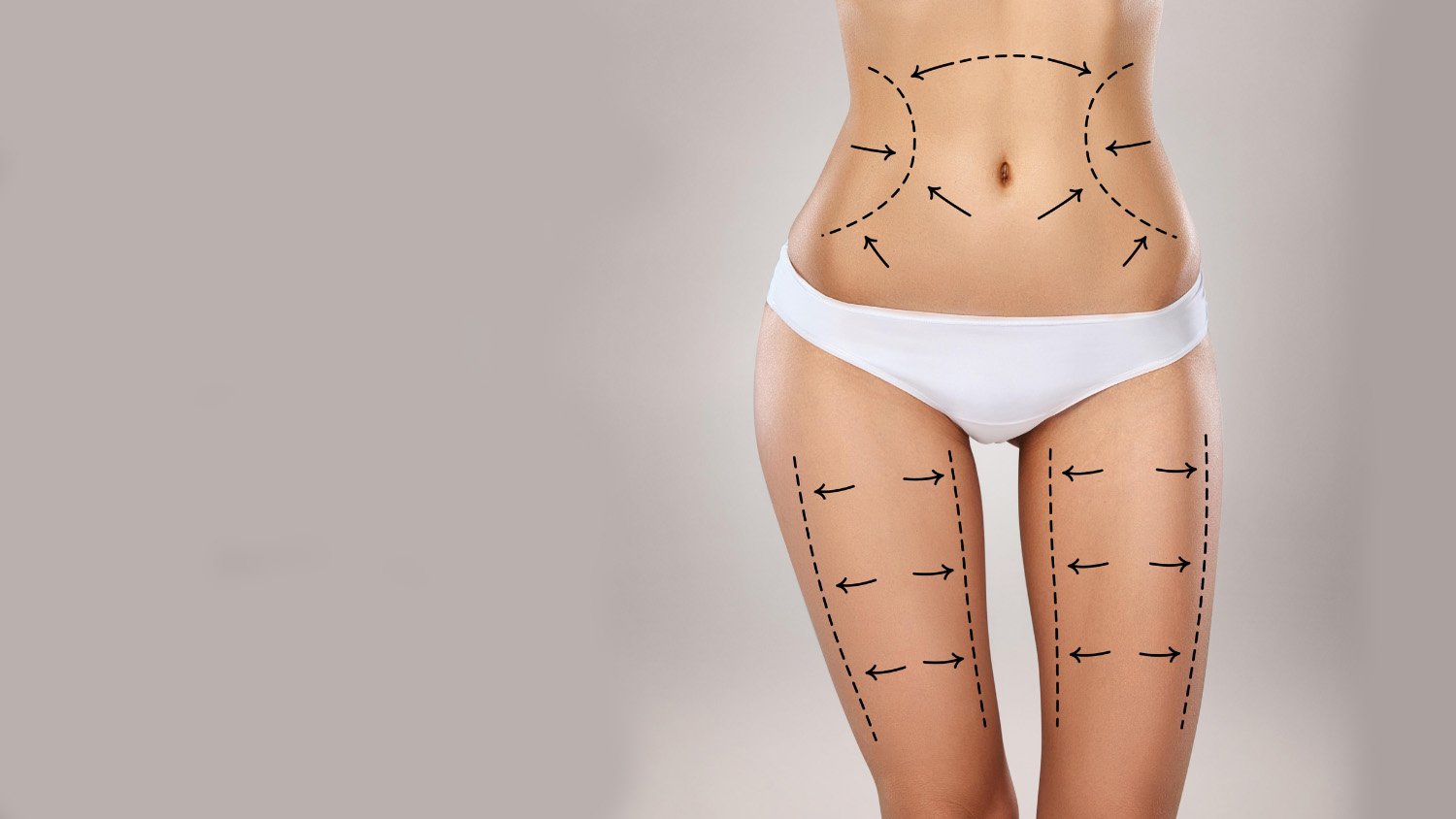 LIPOSUCTION (YAĞ ALDIRMA)